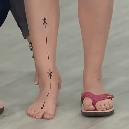 Women's orthopedic sandals displayed on a clean surface highlighting straps