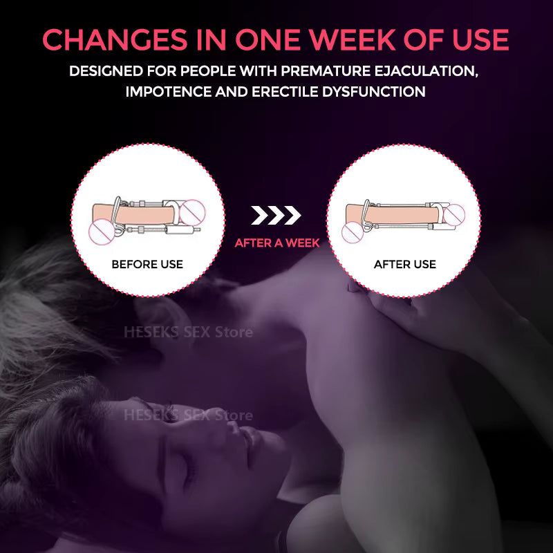 Secure grip feature on the black and white male support tool