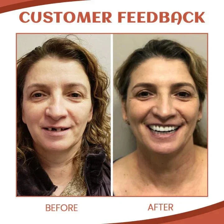 Complete cosmetic teeth set for improved confidence and oral aesthetics