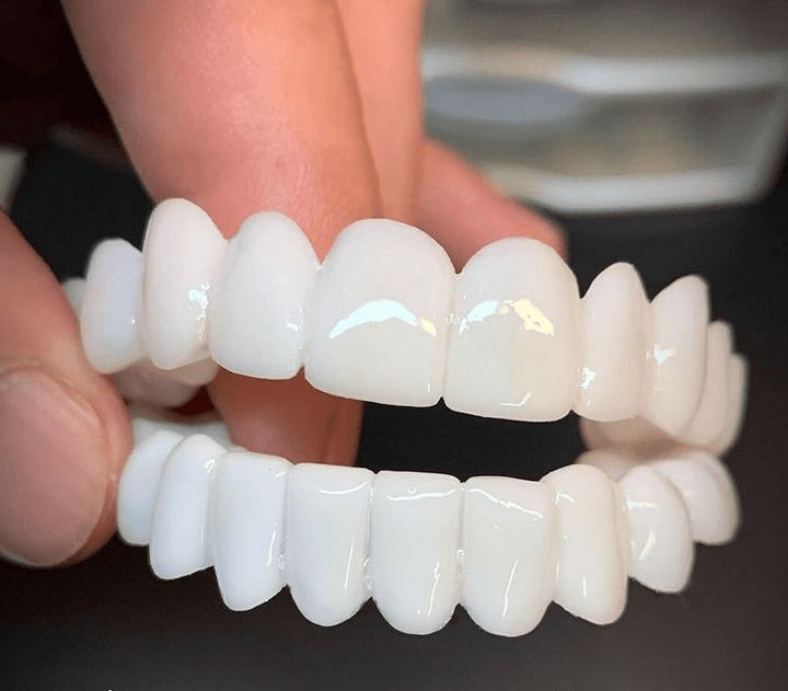 Close-up view of reusable upper and lower dental veneer lenses held in hand